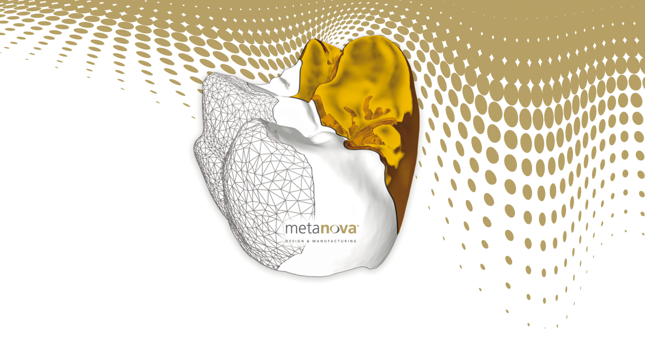 3Shape Metanova Scanner